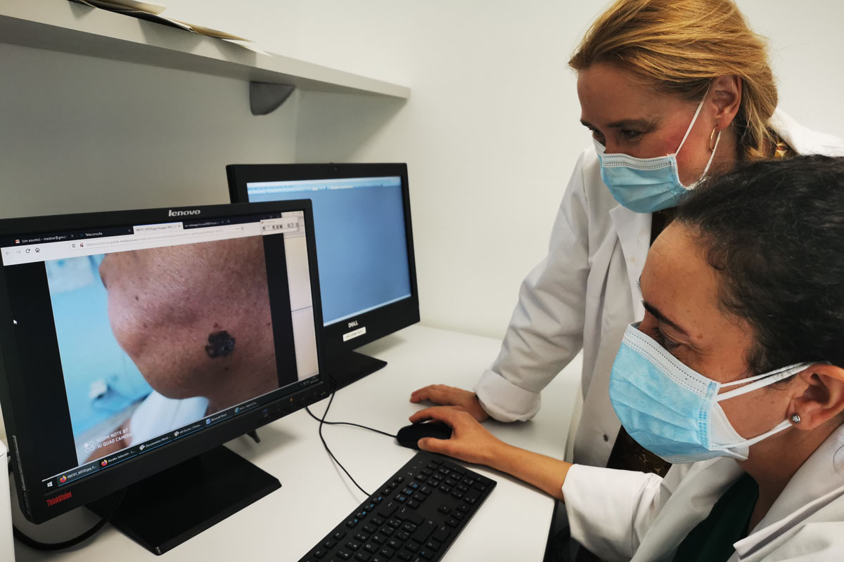 El impacto del Covid 19 reduce en un 62% la detección precoz del melanoma