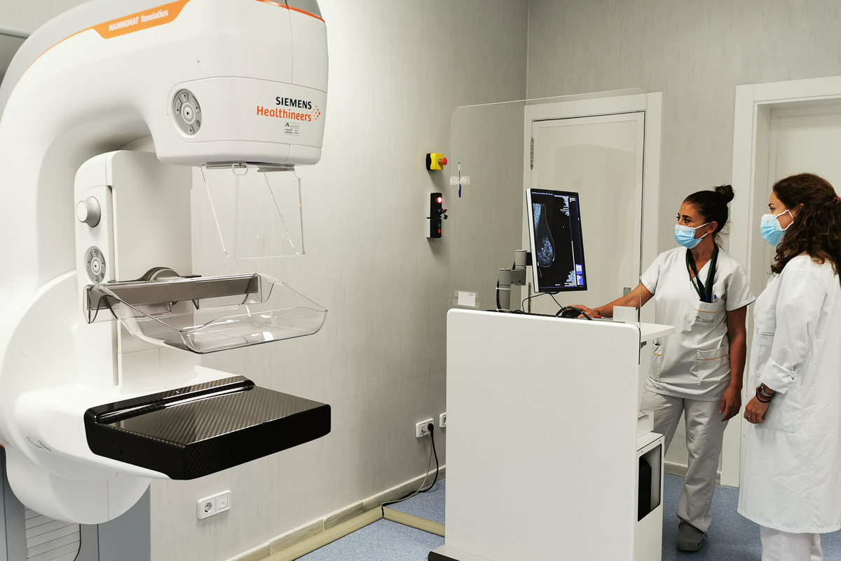 Nuevo mamógrafo de última generación en el Hospital Costa del Sol